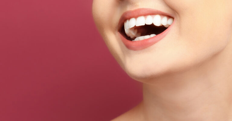 clareamento dental em itapevi